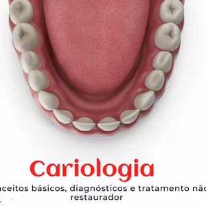 Imagem de capa para o Ebook cariologia