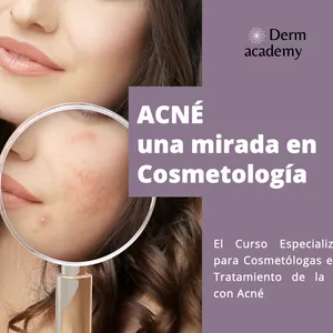 Imagen de portada para Curso online Acné una mirada en cosmetología