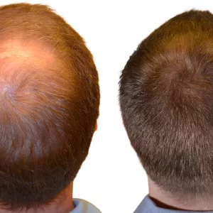 Imagen de portada para Curso online Guia de Reconstrucción Capilar