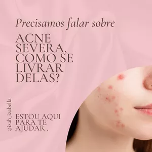 Imagem do curso Livre-se das espinhas (acne) de uma vez por todas.