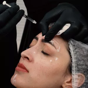 Imagem de capa para o Curso online Método Softlines Glow - Toxina Botulínica