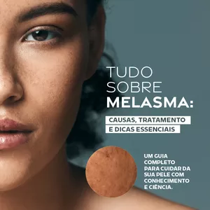 Imagem de capa para o Ebook TUDO SOBRE MELASMA: CAUSAS, TRATAMENTO E DICAS ESSENCIAIS
