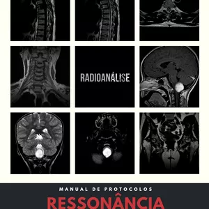 Imagem de capa para o Ebook 1° edição protocolos de ressonância magnética Radioanálise