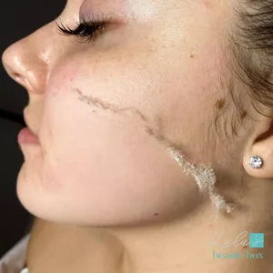Imagem do curso DERMAPLANING o peeling das Hollywoodianas