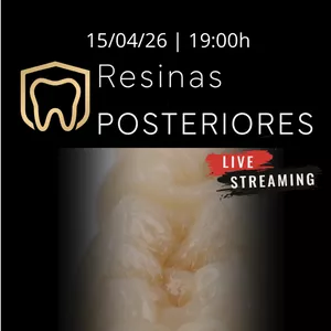 Imagem de capa para o Curso online Imersão em Resinas Posteriores [ao vivo]