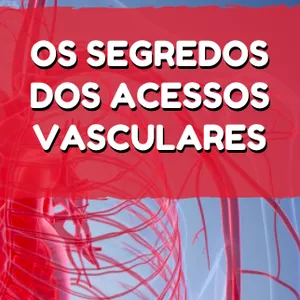 Imagem de capa para o Ebook E-Book - Os Segredos dos Acessos Vasculares