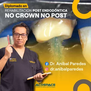 Imagen de portada para Curso online Diplomado en Rehabilitación post endodóntica