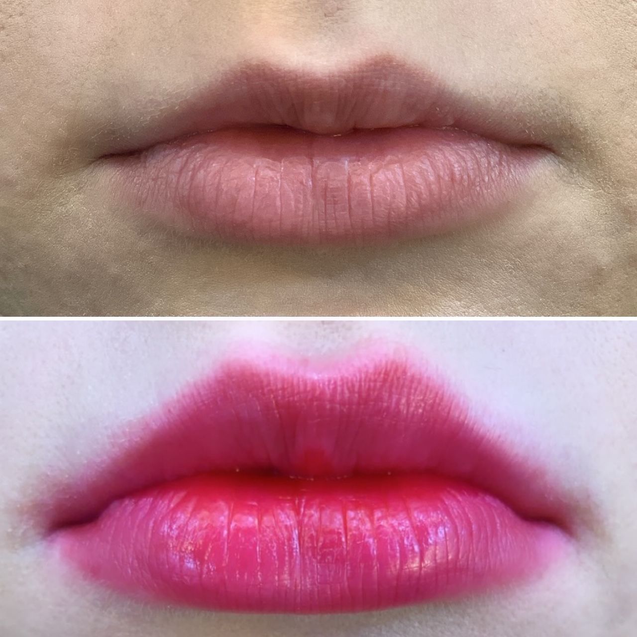 Imagem do curso Curso Alpha Lips - Revitalização labial 