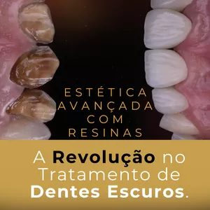 Imagem de capa para o Evento online Estética avançada com resinas: A Revolução no Tratamento de Dentes Escuros