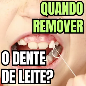 Imagem de capa para o Ebook PDF - Qual é o momento correto para fazer a exodontia do dente decíduo - aula 66