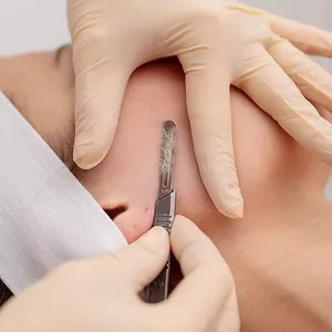 Imagem de capa para o Curso online MSP ( DERMAPLANING)