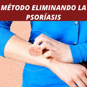 Imagem de capa para o Curso online ELIMINANDO LA PSORIASIS