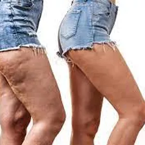 Cover image for Ebook Cellulite? Get Rid of It!