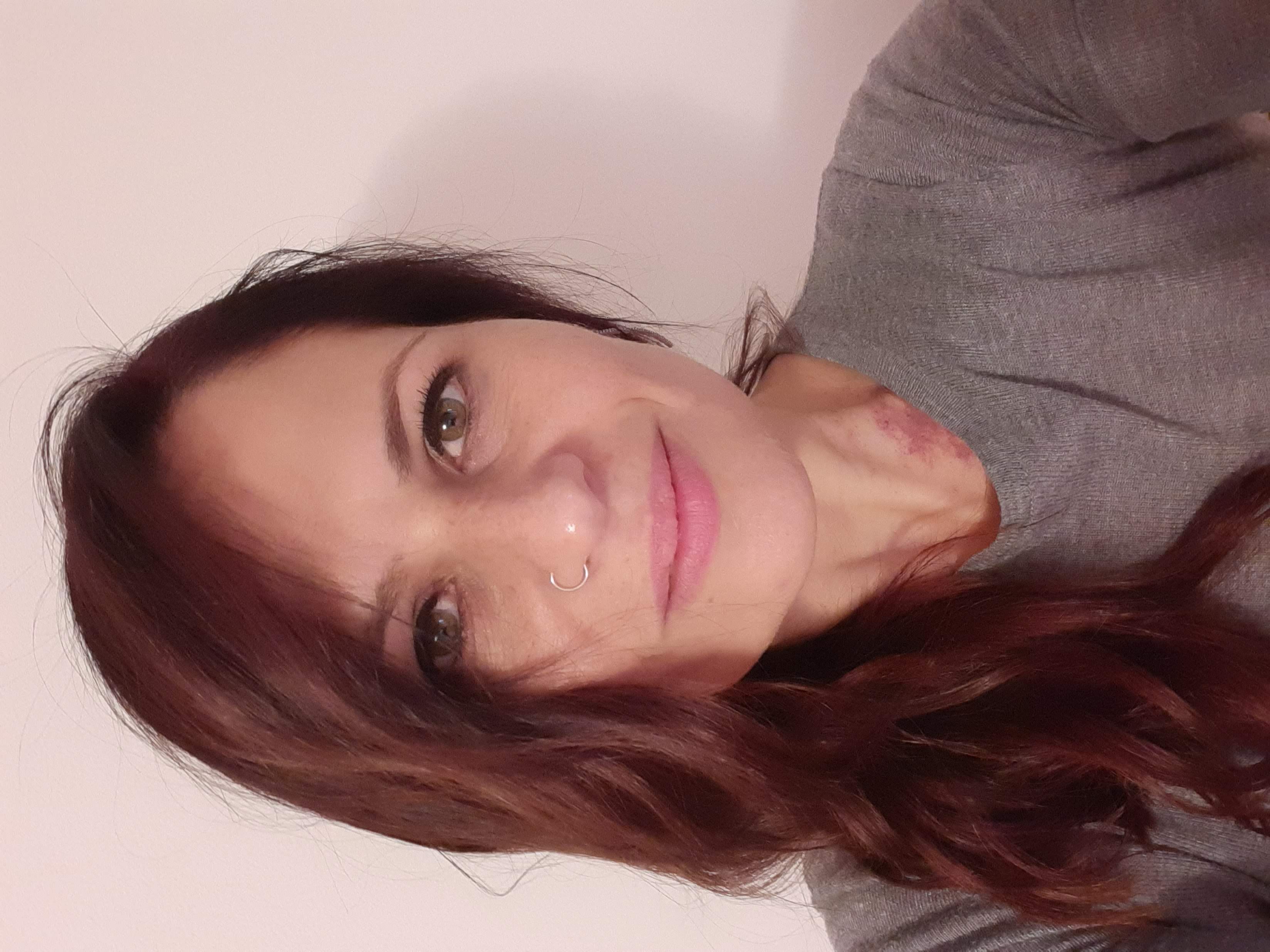 Lorenza Moscarella