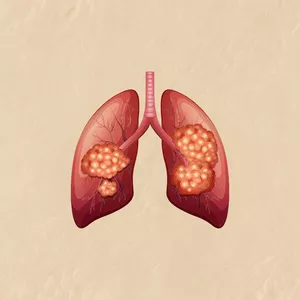 Imagem de capa para o Ebook Mapa mental: Câncer Pulmonar