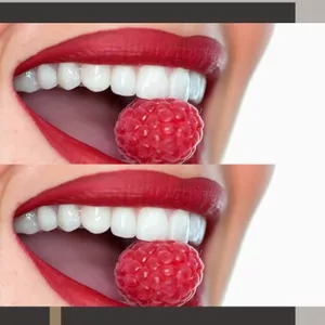 Imagen de portada para Ebook DIENTES&nbsp;MAS&nbsp;BLANCOS