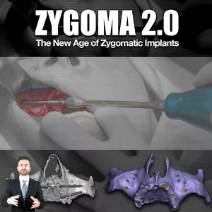 Cover image for Online course ZYGOMA 2.0 - The New Age of Zygomatic Implants