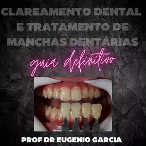 Imagem do curso Clareamento dental e tratamento de manchas dentárias, guia definitivo. (con subtítulos en español)
