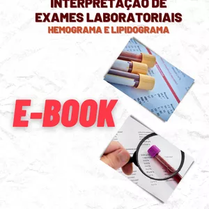 Imagem de capa para o Ebook eBook Interpretação de Exames Laboratoriais - hemograma e lipidograma