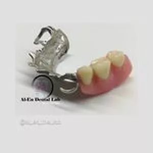 Imagen de portada para Curso online PPR Metálica Removible Diseño Digital, (Del Escaneo hasta el Pulido).