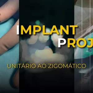 Imagem de capa para o Curso online Tip-The Implant Project