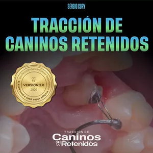 Imagen de portada para Ebook Manual Traccion de Caninos Retenidos- Diagnostico, Interceptación y Traccion Clínica Paso a Paso
