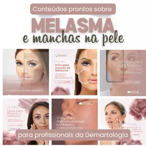 Imagem de capa para o Curso online Pack Melasma e Manchas de Pele