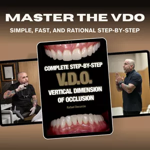 Cover image for Ebook PRACTICAL GUIDE – VERTICAL DIMENSION OF OCCLUSION (V.D.O.)