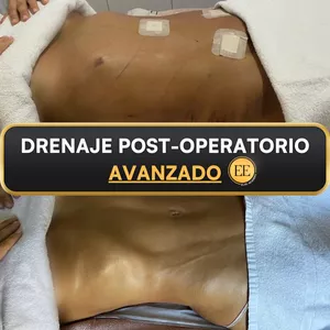 Imagen de portada para Curso online Drenaje Postoperatorio Avanzado