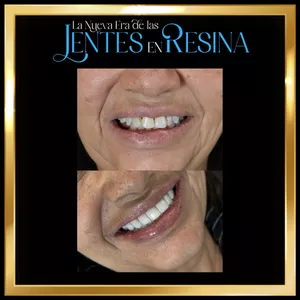 Imagen de portada para Evento presencial 2 CLASES EN VIVO- PROMOCIÓN 2 CUPOS 