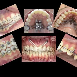 Imagem de capa para o Curso online Mini-Implantes na Prática (em português)