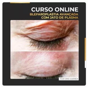 Imagem de Curso de Blefaroplastia Avançada criado por Cristiane C. dos Santos na hotmart