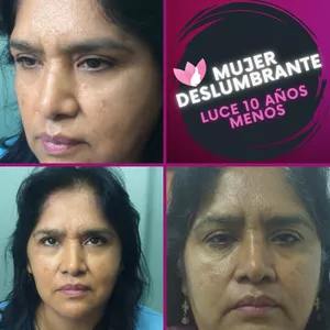 Imagen de portada para Curso online REJUVENCE EN CASA SIN SER UNA EXPERTA ESTETICISTA