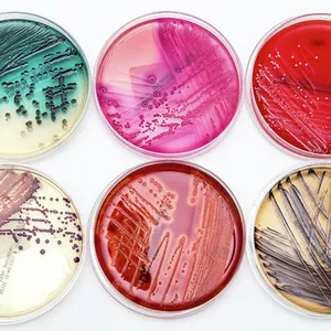 Imagem de capa para o Curso online Microbiologia Clínica Bacteriana: Procedimentos Básicos e Conceitos Gerais