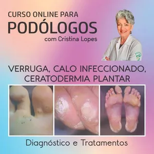 Imagem do curso Verruga Plantar, Calo Infeccionado e Ceratodermia Plantar - Diagnóstico e Tratamentos
