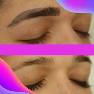 Imagem de capa para o Curso online Curso de Despigmentação Vegana