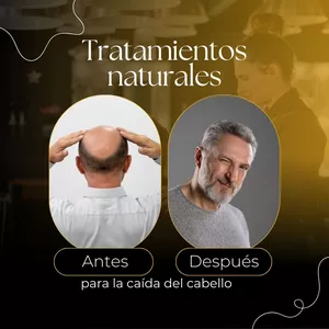 Imagen de portada para Ebook Tratamientos naturales para la caída del cabello   