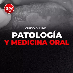 Imagen de portada para Curso online CURSO ONLINE PATOLOGIA Y MEDICINA ORAL | AGC