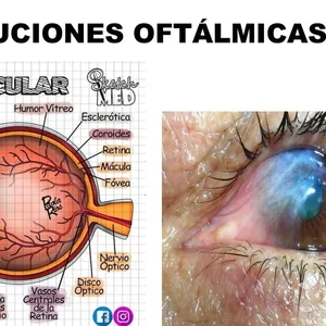 Imagen de portada para Ebook FÁRMACOS-PDF (Solucion Opticas y Oftalmicas) Enfermeria-2024