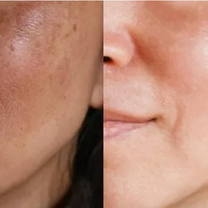 Imagem de capa para o Ebook Remova suas manchas