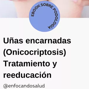 Imagen de portada para Ebook Onicocriptosis (uñas encarnadas) tratamiento y reeducación 