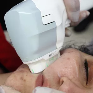 Imagem do curso ULTRASSOM MICROFOCADO 