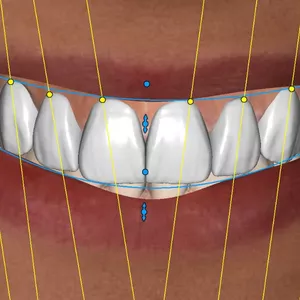 Imagem de Curso Enceramento digital  criado por Grin Design  na hotmart