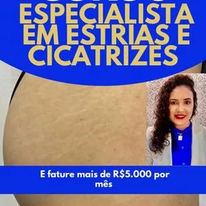 Imagem de capa para o Ebook CURSO DE ESPECIALISTA EM ESTRIAS E CICATRIZES