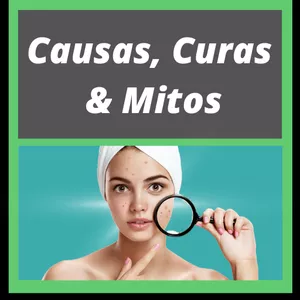 Imagem de capa para o Ebook APRENDENDO SOBRE A ACNE