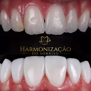 Imagem de capa para o Curso online Harmonização do sorriso