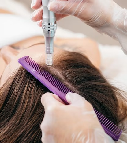 Imagem do curso Terapia Capilar - Calvice Zero
