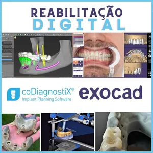 Imagem de capa para o Curso online REABILITAÇÃO ODONTOLÓGICA NO FLUXO DIGITAL - PROGRAMAS CODIAGNOSTIX E EXOCAD 