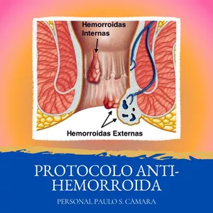 Imagem do curso Protocolo ANTI-HEMORROIDA