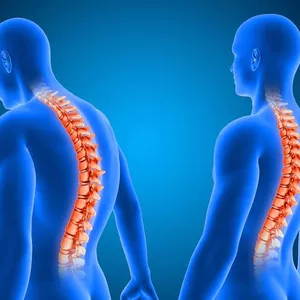 Cover image for Online course Package - Marketing for Orthopedics - Physiotherapy